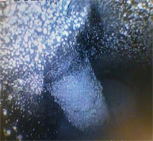 黑不溜秋的還有粉末狀,好惡心~